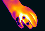 flir medical